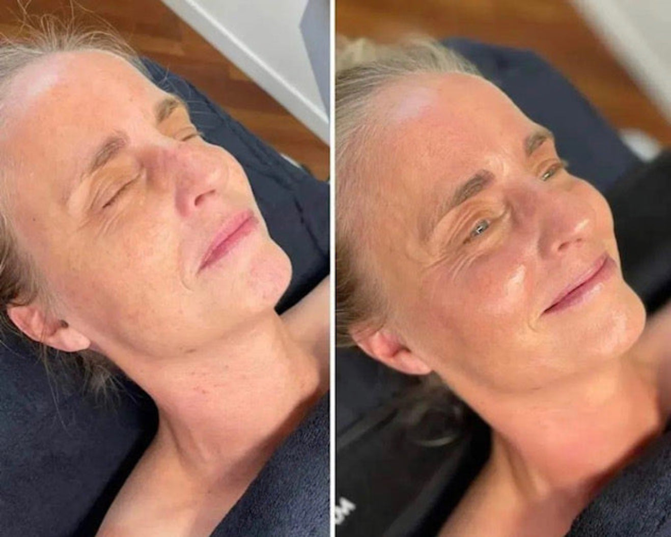 negleteknikker ordner en persons negle