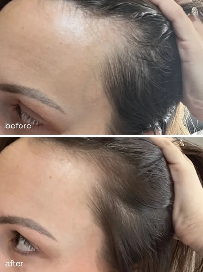 UKHAIR Hair Growth Serum - 50ml
